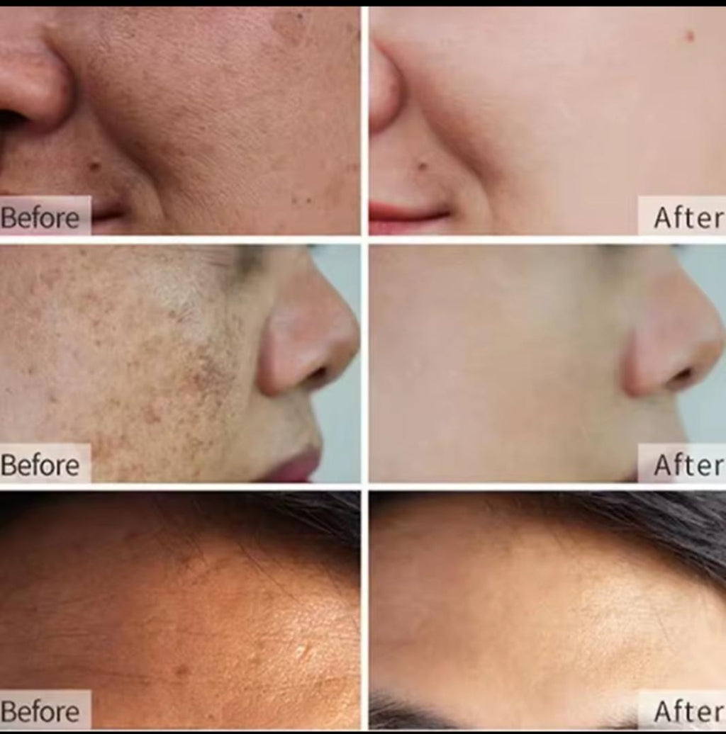 Crème Correctrice Anti-Taches