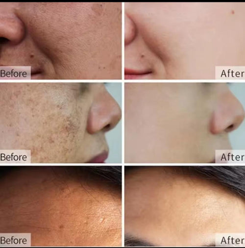 Crème Correctrice Anti-Taches